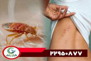 درمان همه چیز درباره نیش ساس: علائم، درمان و راه های پیشگیری از آن