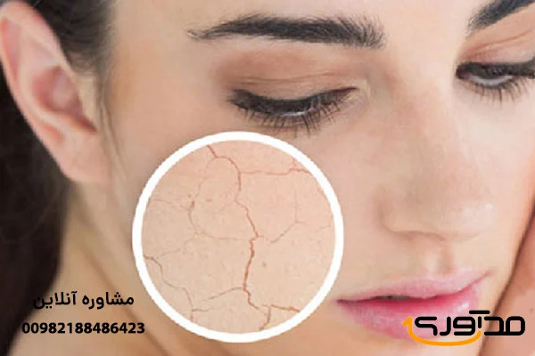 پوست چگونه پوستی بدون نقص داشته باشیم؟