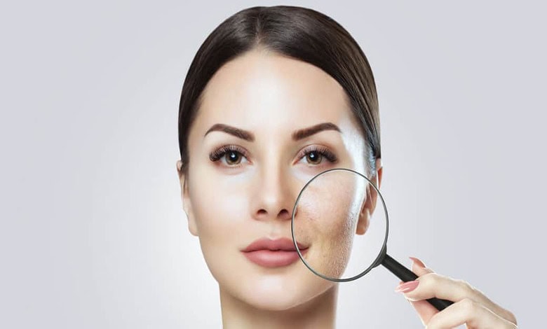 نکات مهم برای داشتن پوستی صاف و بدون منافذ