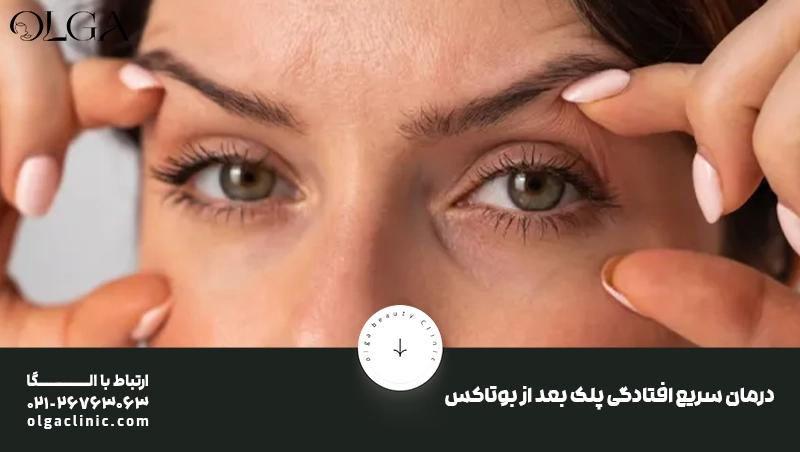 درمان | بوتاکس درمان خانگی افتادگی پلک بعد از بوتاکس