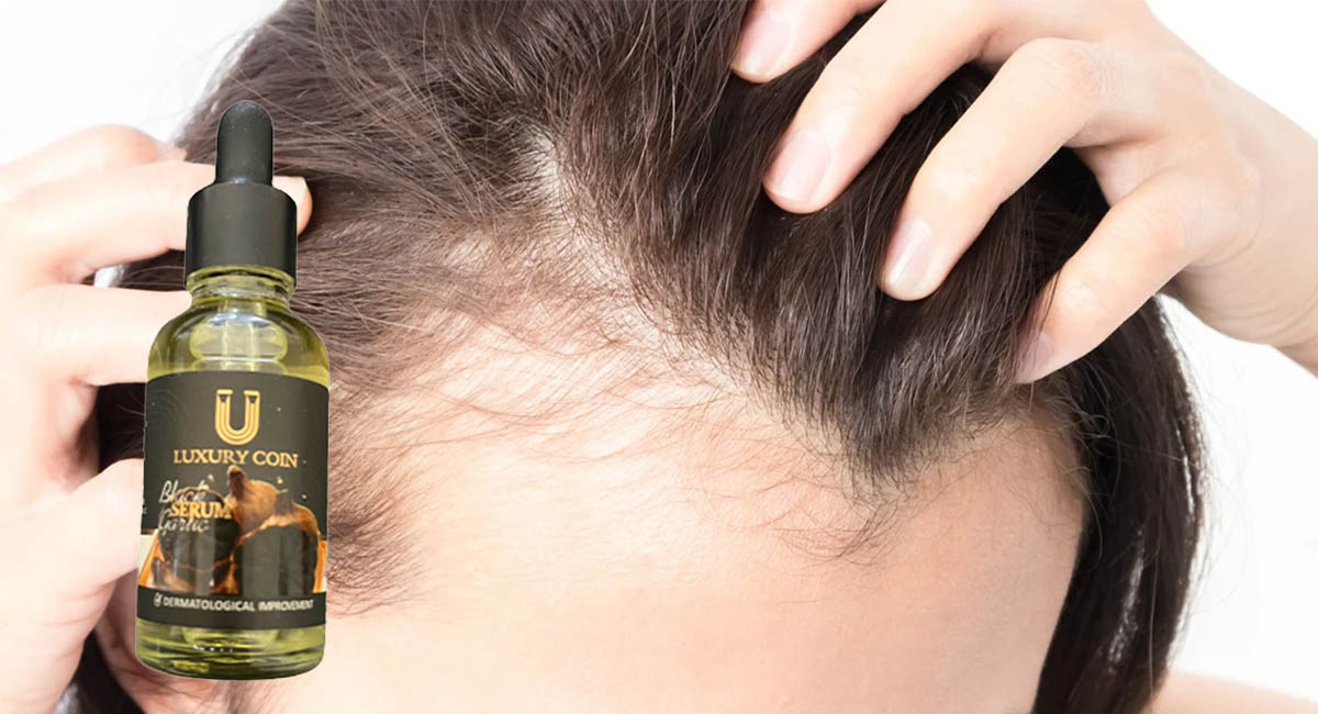 تقویت ریشه و افزایش ضخامت تارهای مو