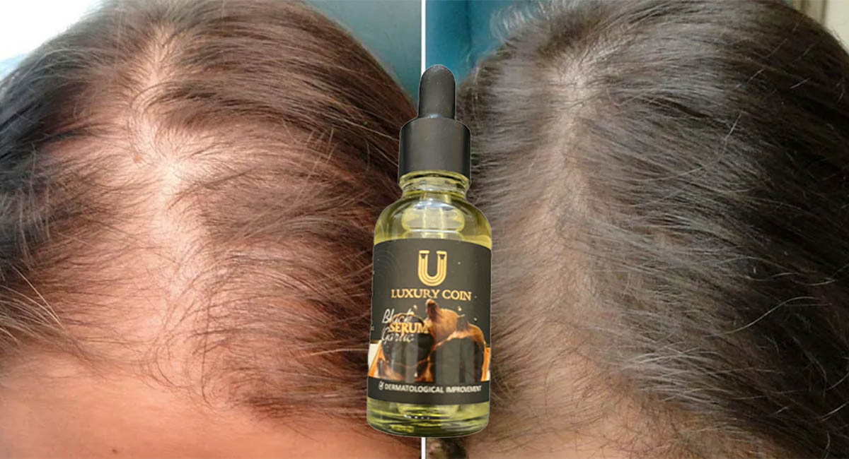 سرم سیر سیاه چیست؟